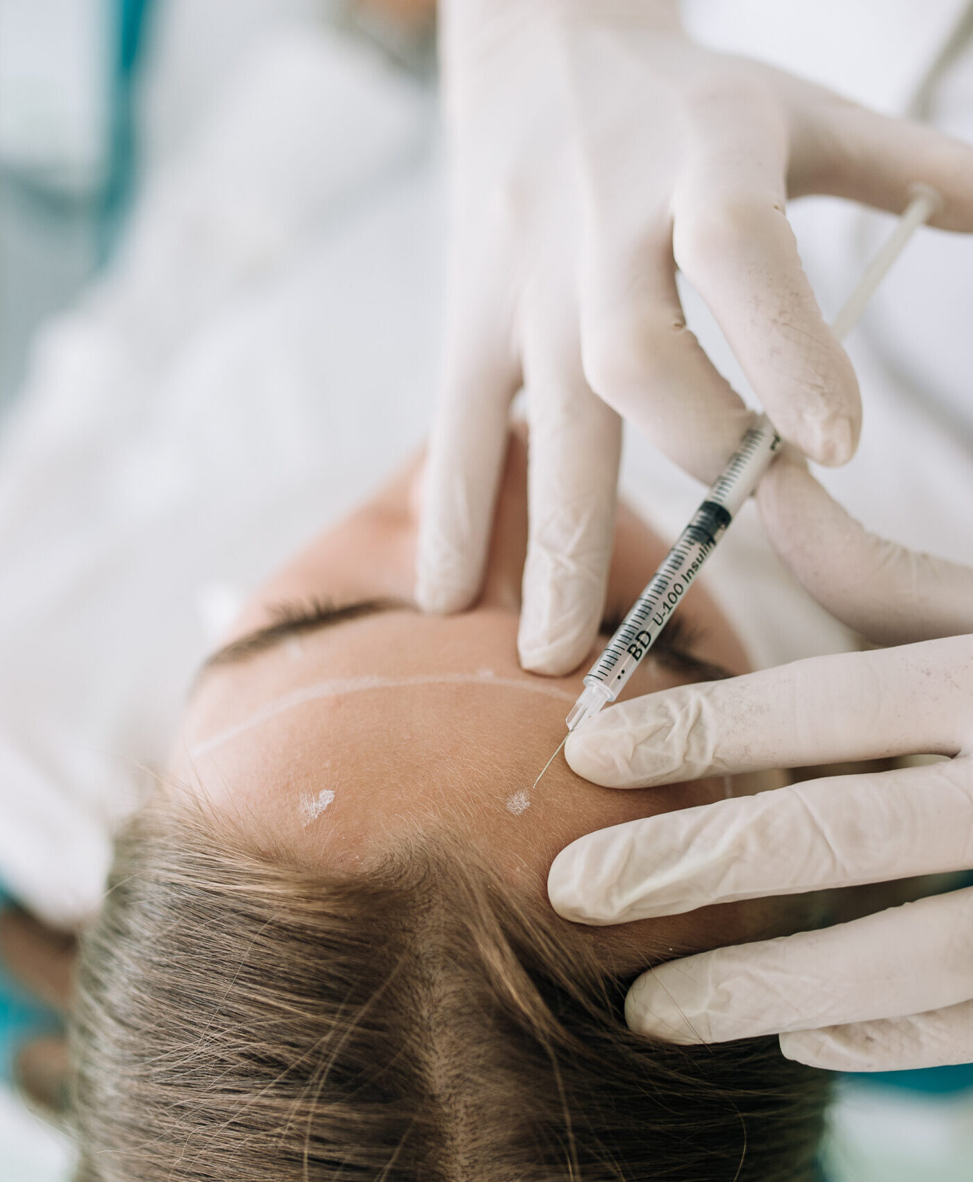 lepotna medicina lukan - botox